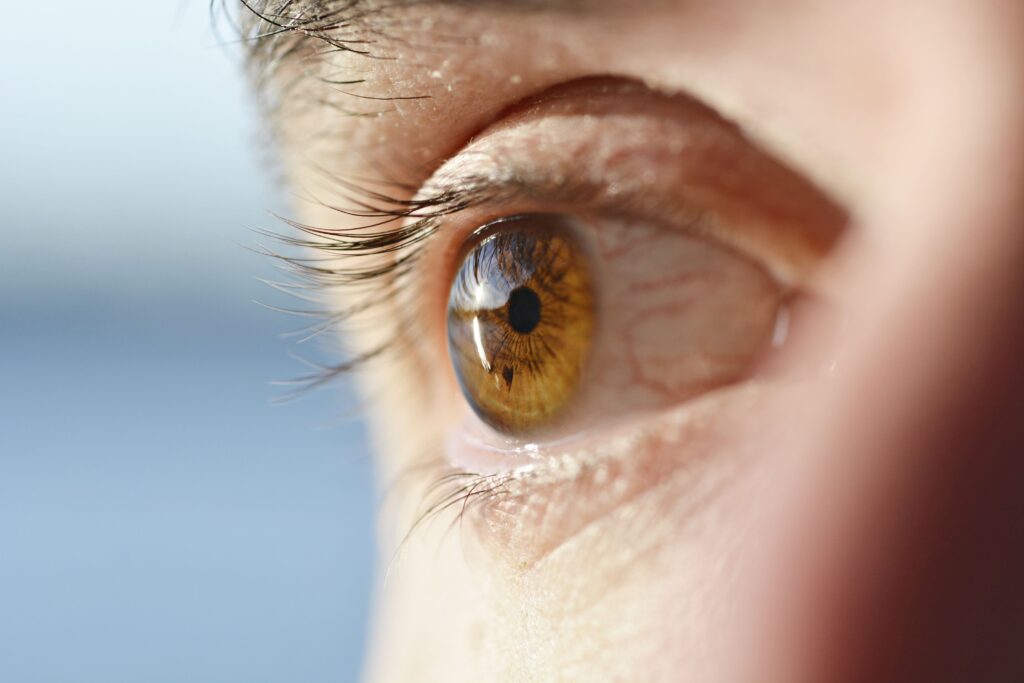 Lasik Eye Surgery